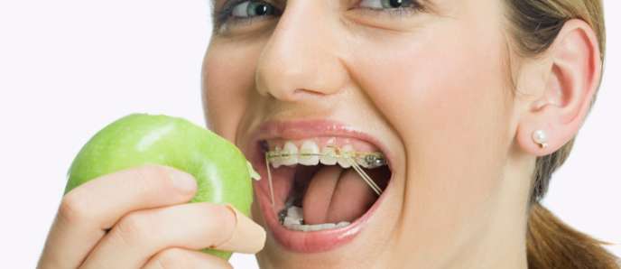 Don’t Eat That: Foods to Avoid While Wearing Braces