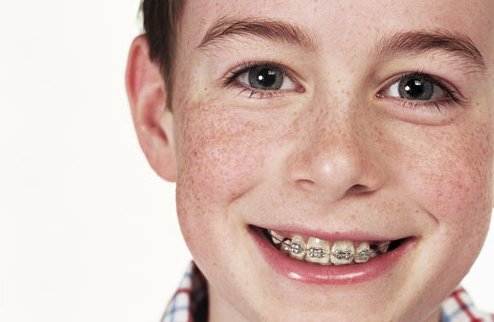 Does my child really need that orthodontic treatment?