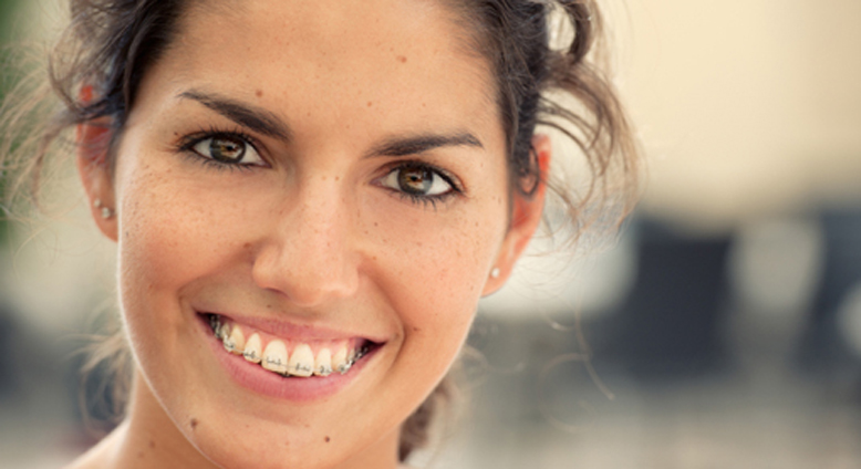 Tips For Adults With Braces