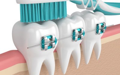 Why must someone visit the Orthodontist?