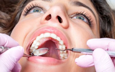 What you need to know about Oral Cancer