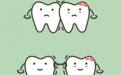 What is Malocclusion?