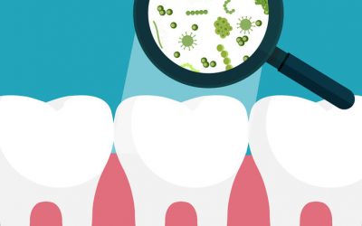 Uncommon Oral Health Issues