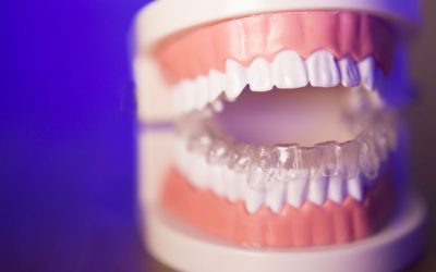 Benefits of Wearing Invisalign!