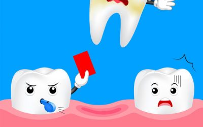 Why Do You Need A Tooth Extraction?