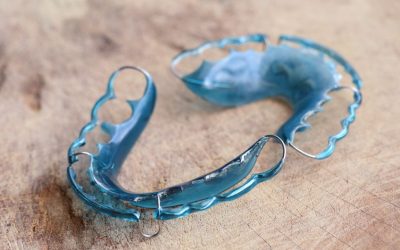 Braces Off, Retainers On