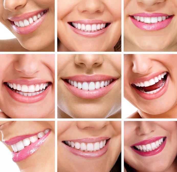 Healthy Teeth for a Beautiful Smile