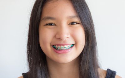 Unveiling the Benefits: Early Orthodontic Treatment for Children